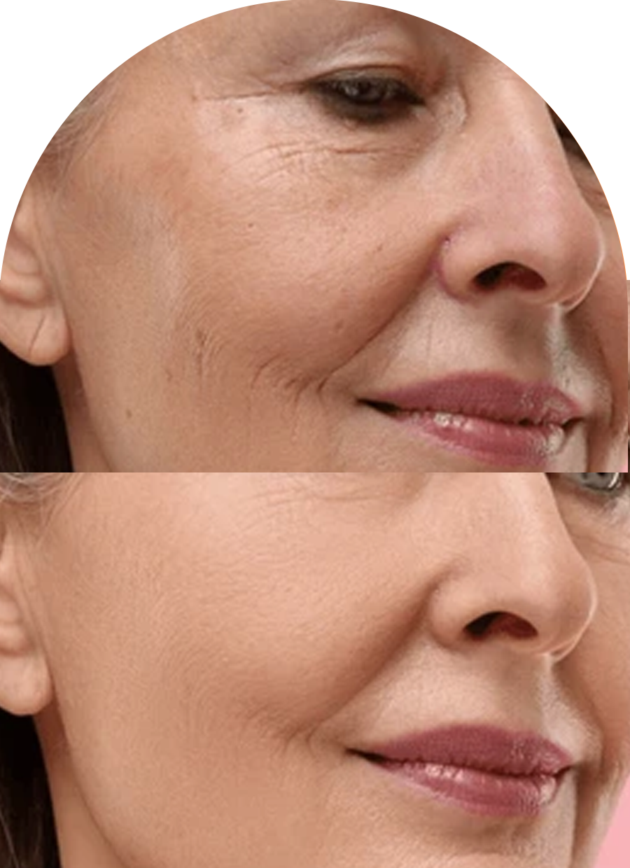 Aesthetic Dermatology