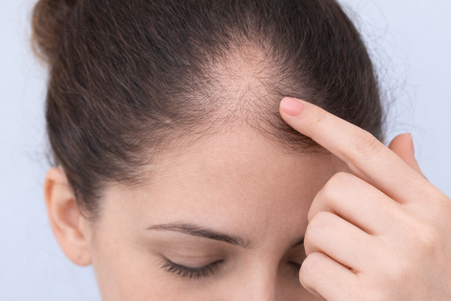 Hair Loss Specialist