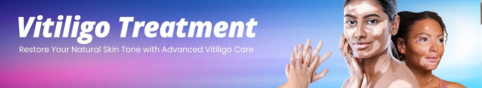 Vitiligo Treatment